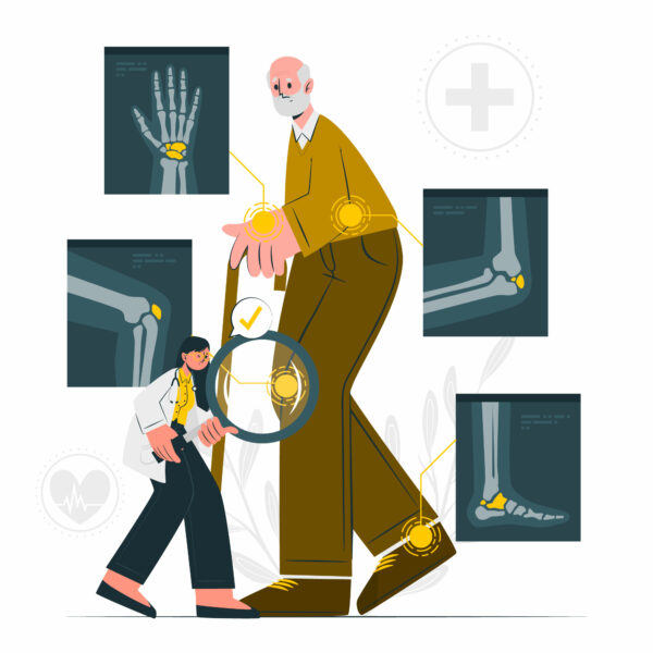 保健医识： 什么是骨质疏松症？